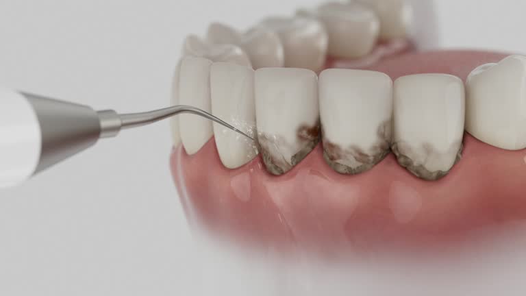 Trusted Root Canal Treatment service in Keene, TX - Dentist Open Now